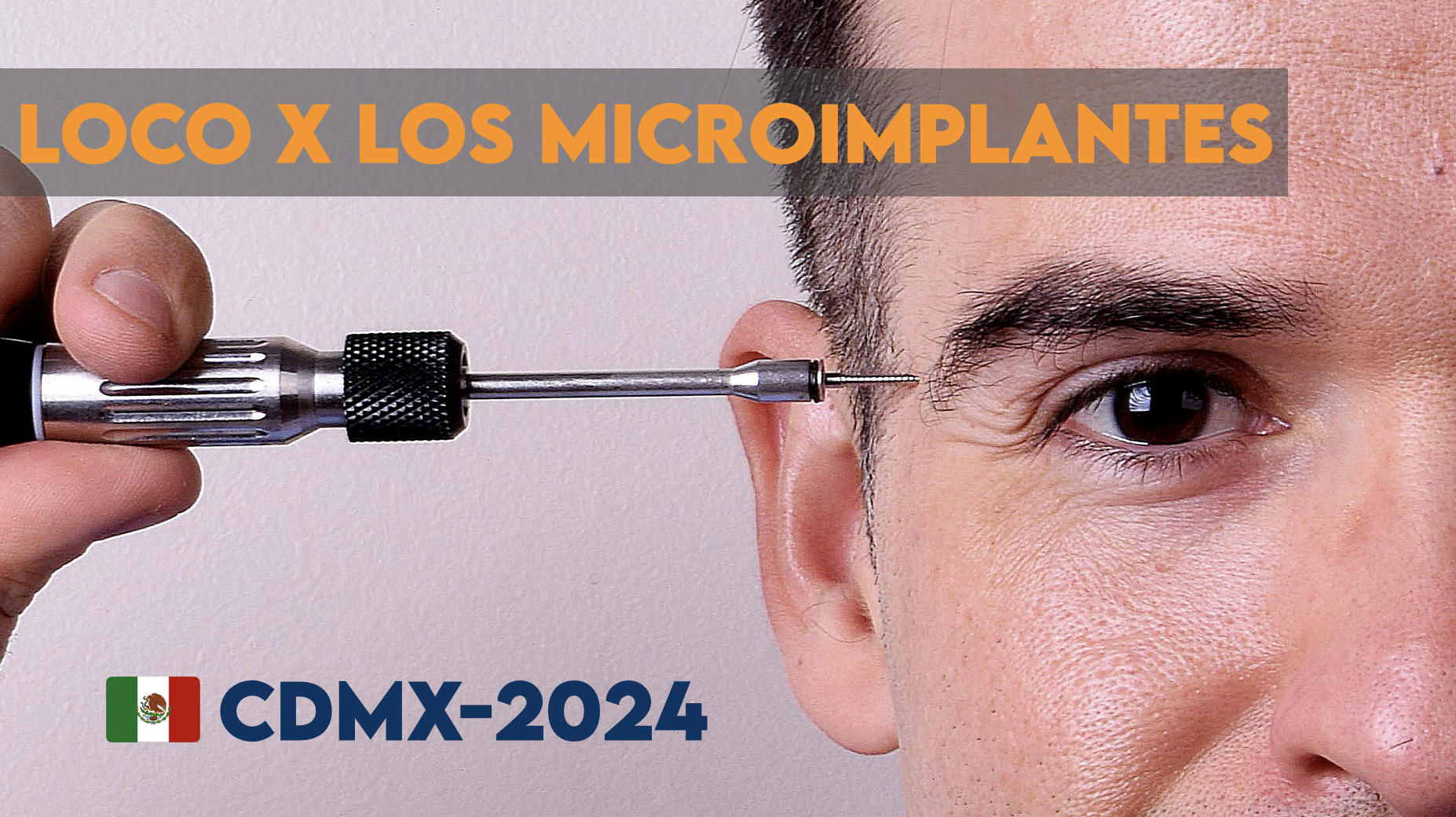 No se pierdan al Dr Daniel Segovia con Loco x los microimplantes en la CDXM