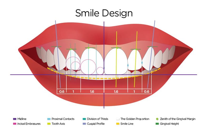 Consideraciones estéticas en ortodoncia
