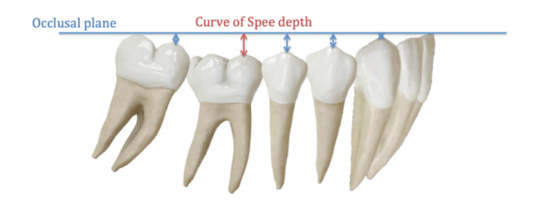 BDR CCLXXII La curva de Spee desde la perspectiva del Ortodoncista